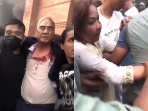 शेरबहादुर देउवा र आरजु देउवा राणामाथि आक्रमण, दुवै घाइते